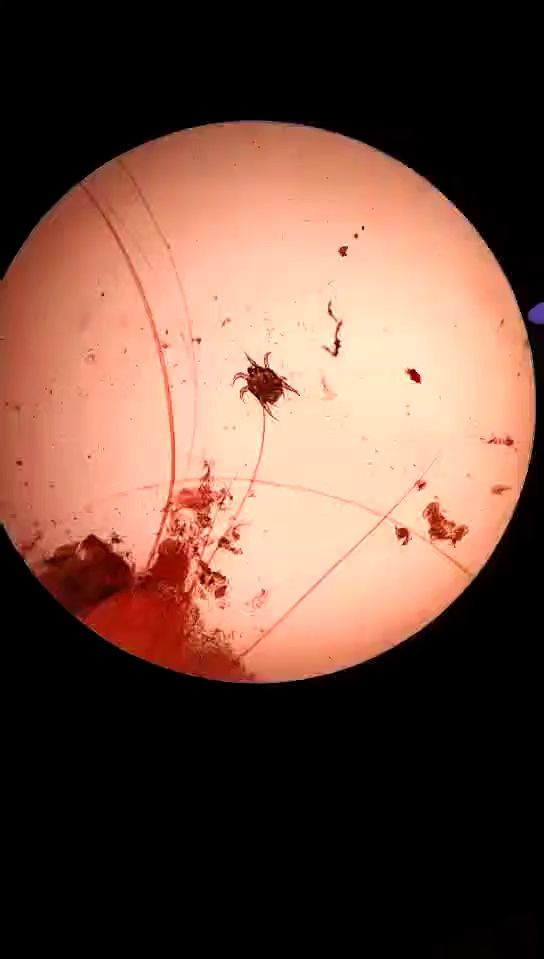 一只猫耳朵里的耳螨,这是显微镜下看的寄生虫,你现在看一只,一会就成