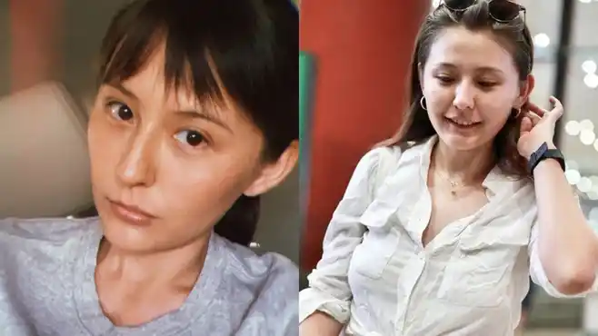 热依扎多处受伤骨折